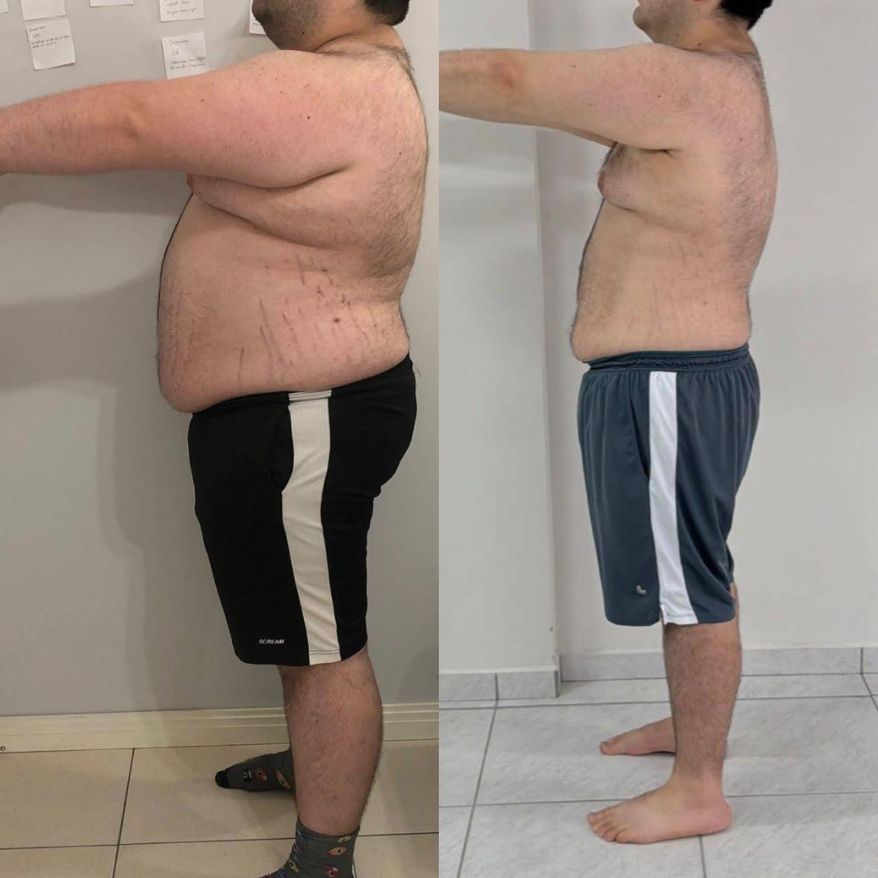 Evolução corporal real de paciente 5